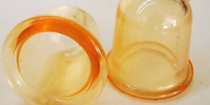 Coppette per il trattamento della prostatite