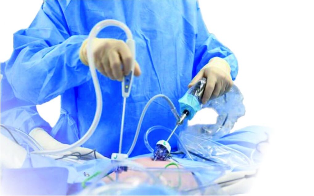 Operazione