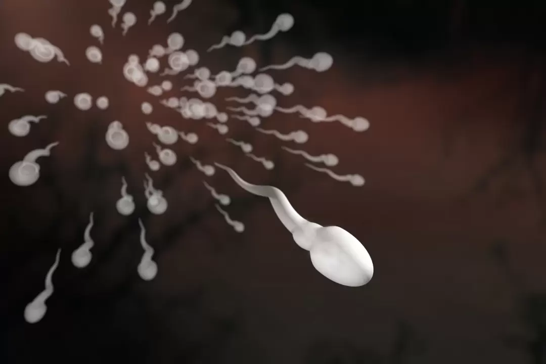 Gli spermatozoi e le loro alterazioni nella prostatite